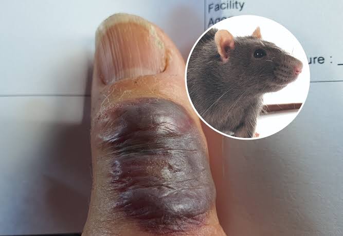 PHC seeks government reply over rat bite deaths in Peshawar