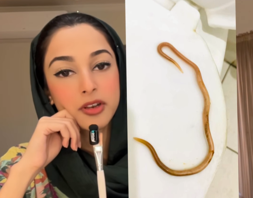 Influencer doctor shows patient’s 3-foot roundworm, warns about eating out too much