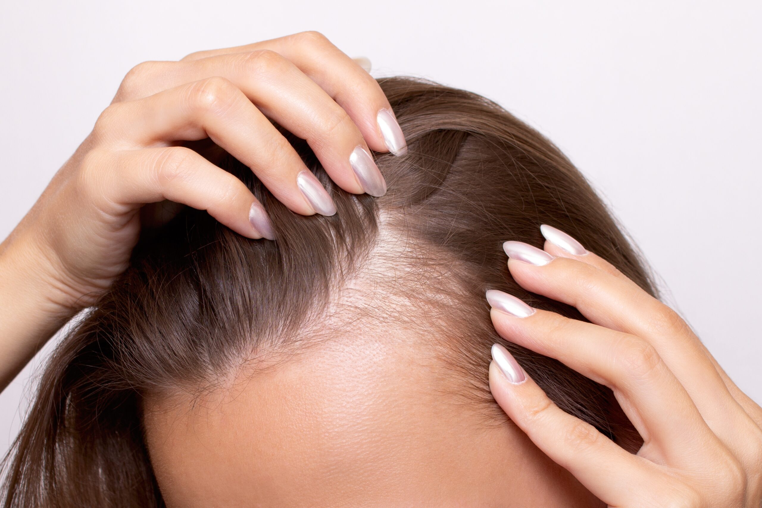 New triple drug treatment shows promise against hair loss