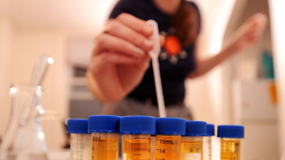 DNA in Rape cases