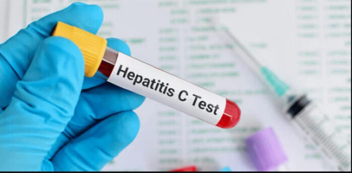 Over one fourth Faisalabites prone to hepatitis