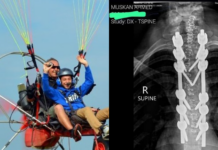 Victim of Karachi paragliding accident takes to social media to clear the air about harrowing experience