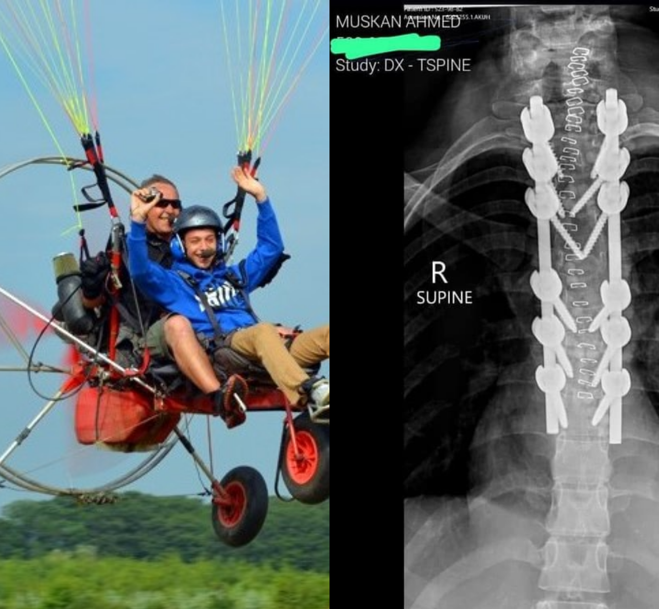 Victim of Karachi paragliding accident takes to social media to clear the air about harrowing experience