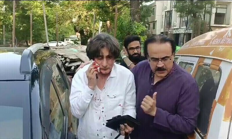 PTI's Raoof Hasan stabbed by unidentified attackers in Islamabad