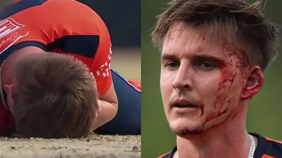 South African bowler bleeds badly after being struck by batsman's powerful shot | Video