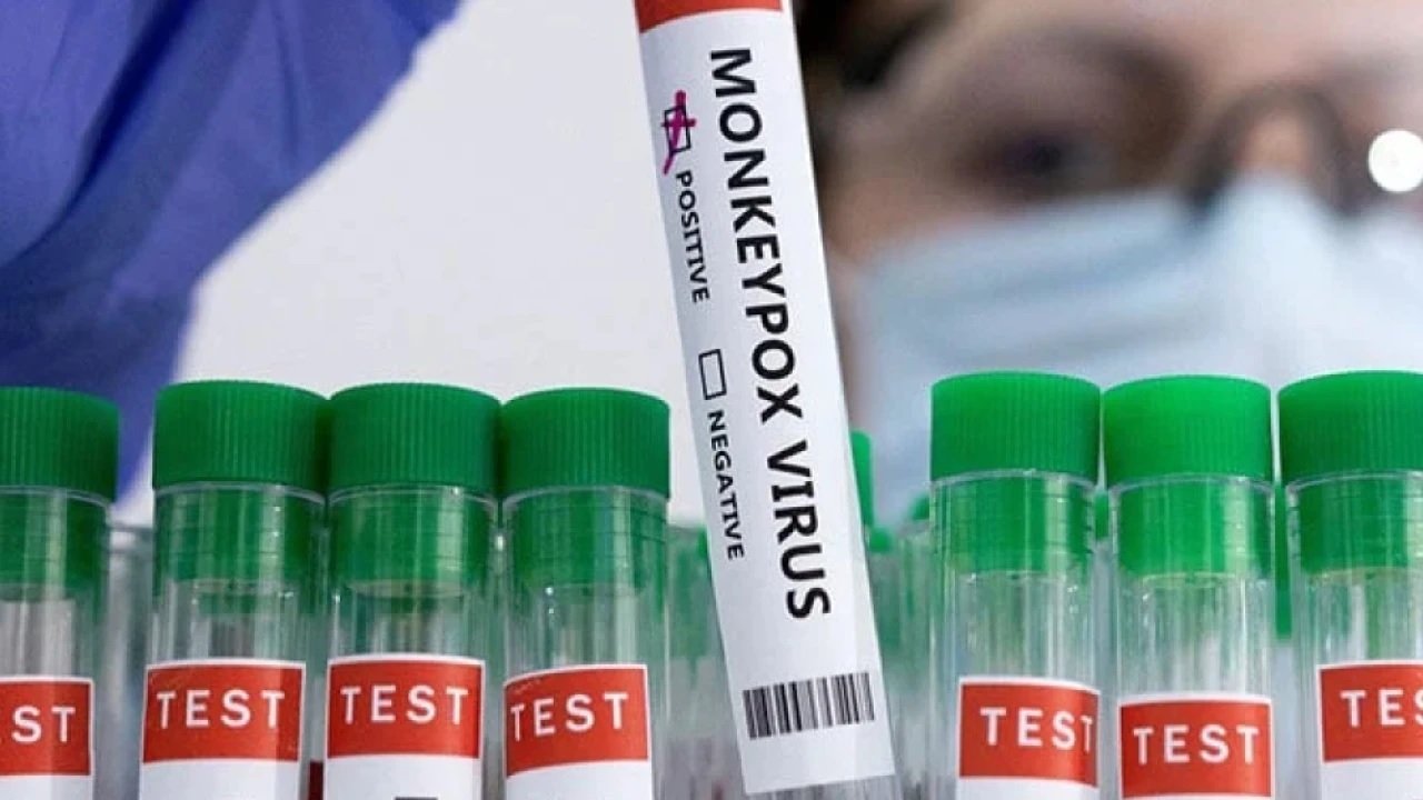 ‘Mpox virus’: Pakistan confirms fifth case in KP: health minister