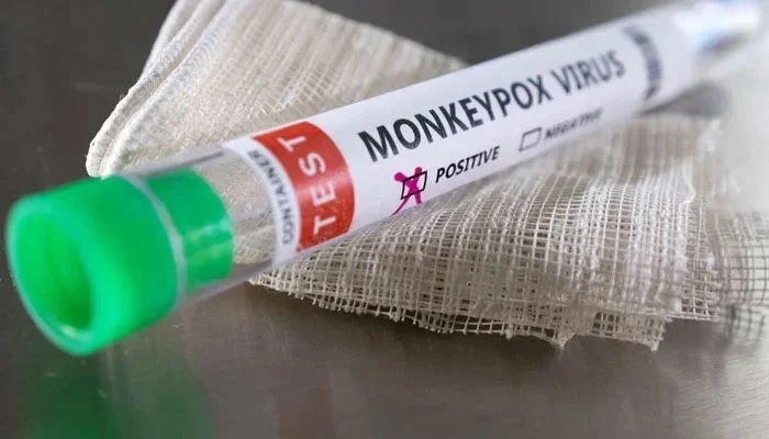 Pakistan confirms third mpox case at KP’s Peshawar airport