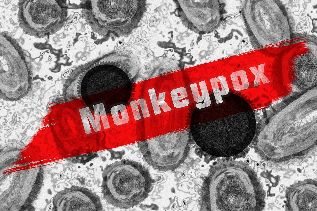 Peshawar becomes epicenter of mpox in Pakistan as fourth case is detected