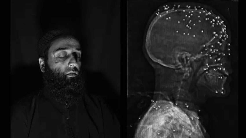 UN-supported report reveals India’s brutal state-backed torture methods in Kashmir