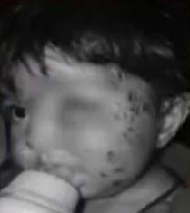 Jackal attack injures family members in village