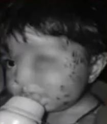 Jackal attack injures family members in village